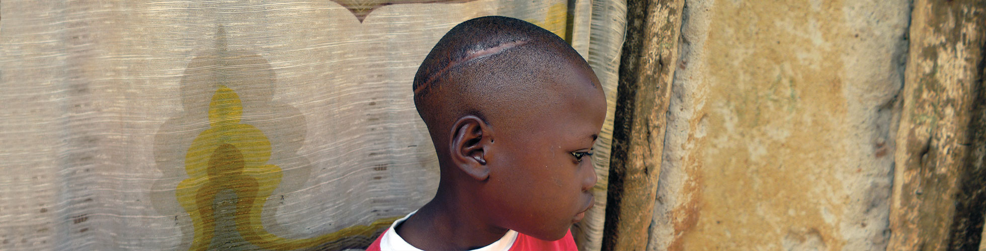Child Sacrifice survivor Allan showing scar on head